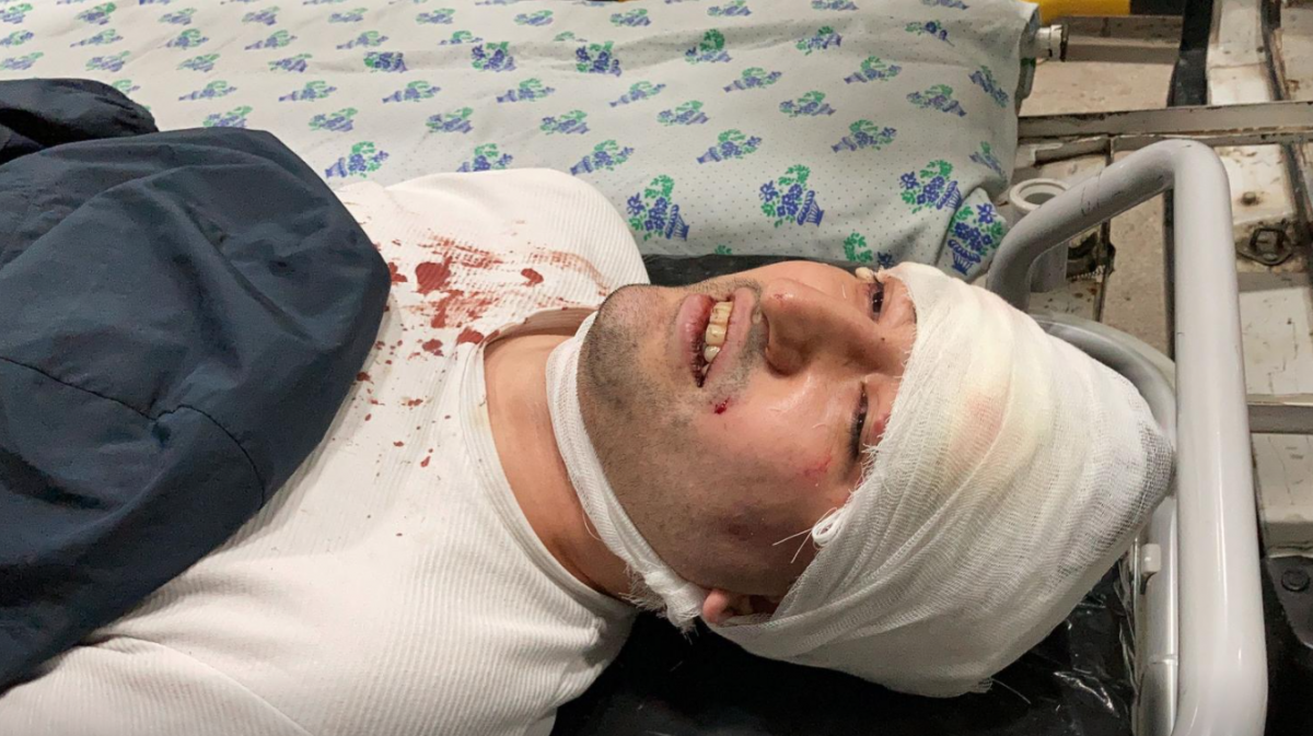 "Государство геев": узбекское ЛГБТ-сообщество вступило в войну