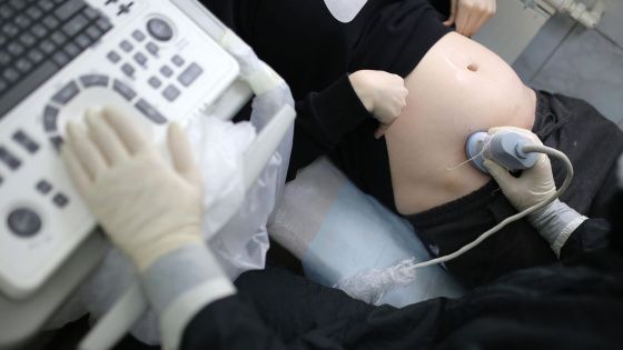 Частная клиника в Новгородской области прекратила проведение ранних абортов